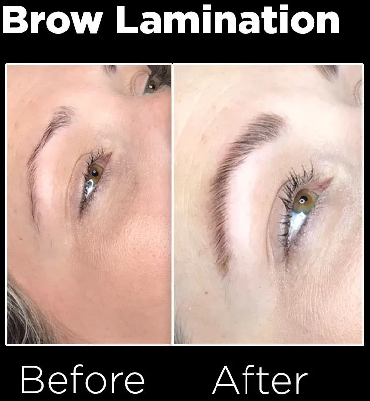 A woman 's brows are being lamination before and after.